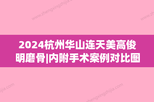 2024杭州华山连天美高俊明磨骨|内附手术案例对比图~(杭州华山高俊明磨骨怎么样)