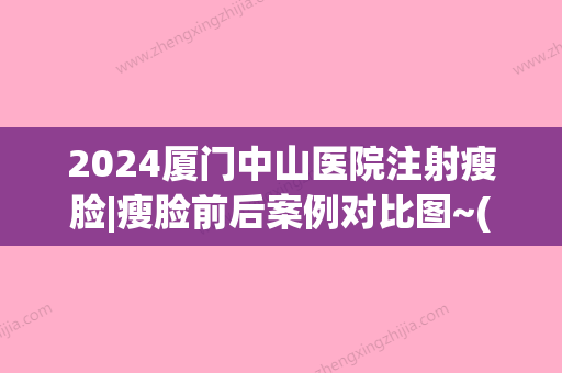 2024厦门中山医院注射瘦脸|瘦脸前后案例对比图~(厦门中山医院洪素庄打瘦脸针)