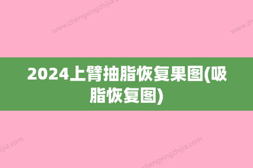 2024上臂抽脂恢复果图(吸脂恢复图)