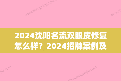 2024沈阳名流双眼皮修复怎么样？2024招牌案例及效果图公布(沈阳双眼皮修复哪位大夫做的好)