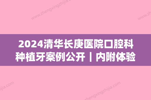 2024清华长庚医院口腔科种植牙案例公开｜内附体验前后对比图(清华长庚医院种植牙多少钱)