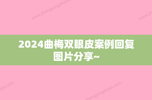 2024曲梅双眼皮案例回复图片分享~