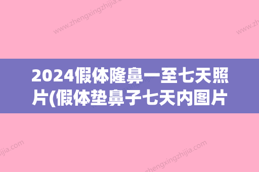 2024假体隆鼻一至七天照片(假体垫鼻子七天内图片)