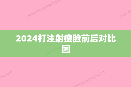 2024打注射瘦脸前后对比图