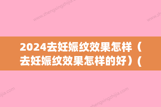 2024去妊娠纹效果怎样（去妊娠纹效果怎样的好）(妊娠纹几年了还能祛吗)