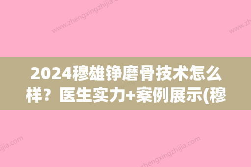 2024穆雄铮磨骨技术怎么样？医生实力+案例展示(穆雄铮磨骨贴吧)