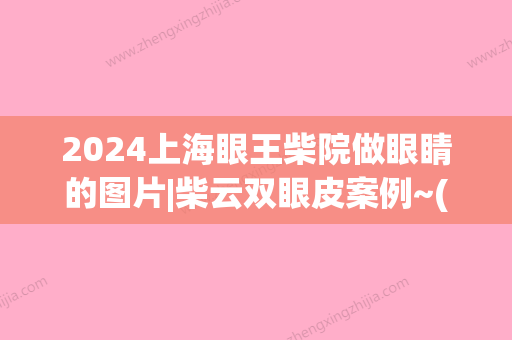 2024上海眼王柴院做眼睛的图片|柴云双眼皮案例~(上海眼王柴云眼睛做的怎么样)