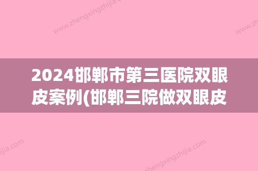 2024邯郸市第三医院双眼皮案例(邯郸三院做双眼皮案例)