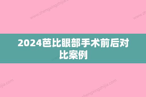 2024芭比眼部手术前后对比案例