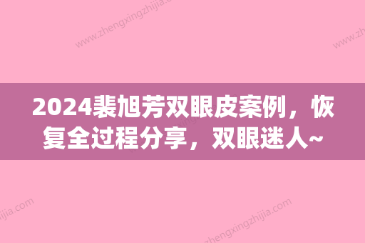 2024裴旭芳双眼皮案例	，恢复全过程分享，双眼迷人~(双眼皮真实案例恢复效果图)