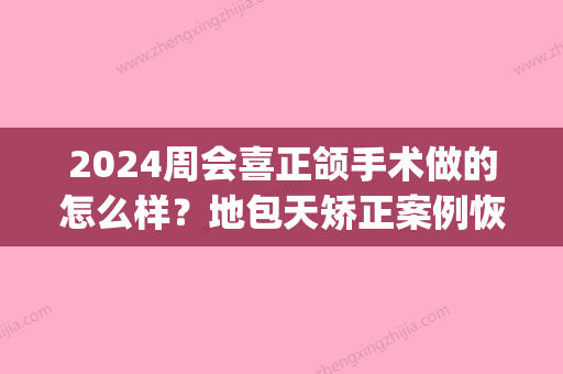 2024周会喜正颌手术做的怎么样？地包天矫正案例恢复全过程(地包天正颌手术恢复时间)