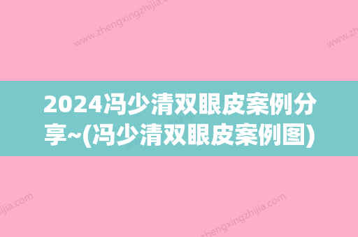 2024冯少清双眼皮案例分享~(冯少清双眼皮案例图)