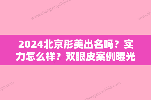 2024北京彤美出名吗？实力怎么样？双眼皮案例曝光~