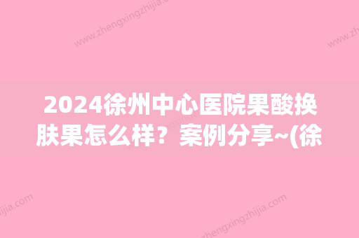 2024徐州中心医院果酸换肤果怎么样？案例分享~(徐州果酸换肤哪家好)