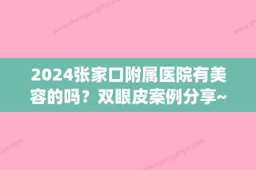 2024张家口附属医院有美容的吗？双眼皮案例分享~(张家口哪里割双眼皮权威医院)