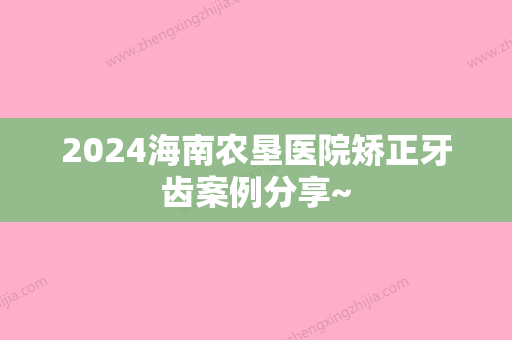 2024海南农垦医院矫正牙齿案例分享~