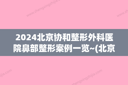 2024北京协和整形外科医院鼻部整形案例一览~(北京协和医院鼻整形谁做的比较好)