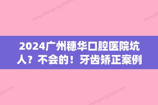 2024广州穗华口腔医院坑人？不会的！牙齿矫正案例分享~(广州穗华口腔医院怎么样啊)