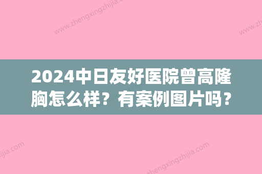 2024中日友好医院曾高隆胸怎么样？有案例图片吗？(中日友好医院增高案例)