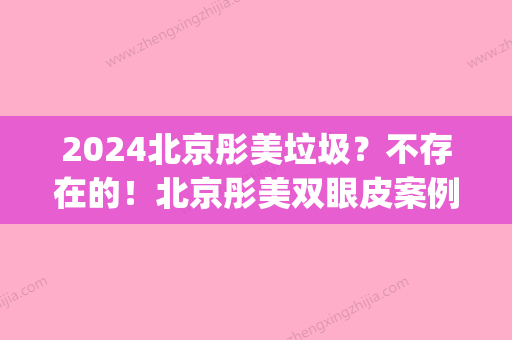 2024北京彤美垃圾？不存在的！北京彤美双眼皮案例分享~(北京彤美整形医院)