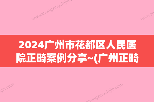 2024广州市花都区人民医院正畸案例分享~(广州正畸医生)