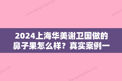 2024上海华美谢卫国做的鼻子果怎么样？真实案例一览~