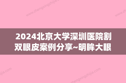 2024北京大学深圳医院割双眼皮案例分享~明眸大眼不是梦~(深圳割双眼皮医生)