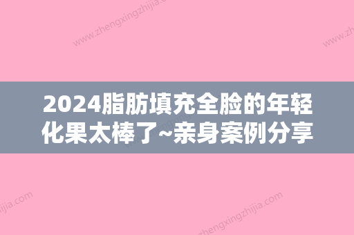 2024脂肪填充全脸的年轻化果太棒了~亲身案例分享~