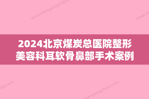 2024北京煤炭总医院整形美容科耳软骨鼻部手术案例，三个月的恢复全记录