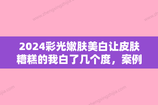 2024彩光嫩肤美白让皮肤糟糕的我白了几个度，案例分享~