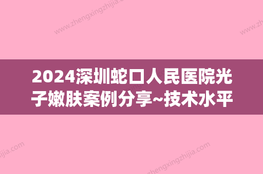 2024深圳蛇口人民医院光子嫩肤案例分享~技术水平特别高！(蛇口人民医院 光子嫩肤)