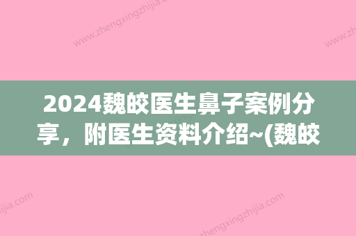 2024魏皎医生鼻子案例分享，附医生资料介绍~(魏皎做鼻子怎么样)