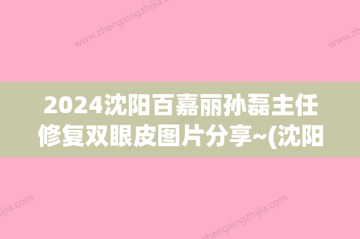 2024沈阳百嘉丽孙磊主任修复双眼皮图片分享~(沈阳百嘉丽双眼皮修复怎么样)