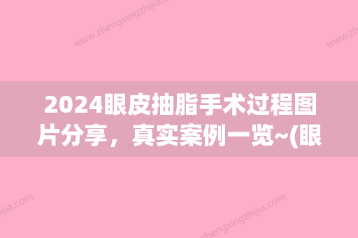 2024眼皮抽脂手术过程图片分享，真实案例一览~(眼部抽脂术价格)