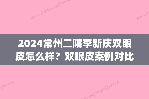 2024常州二院李新庆双眼皮怎么样？双眼皮案例对比图(常州一院和二院哪个做双眼皮好)