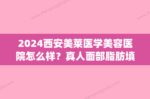 2024西安美莱医学美容医院怎么样？真人面部脂肪填充案例公布(脸部脂肪填充价位)