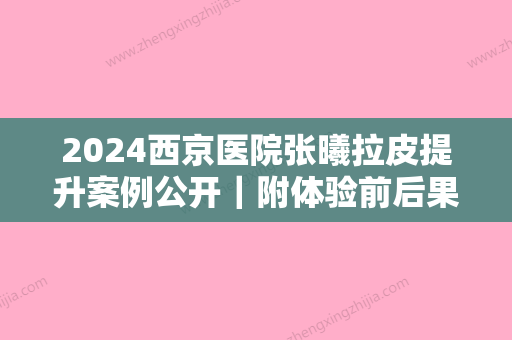 2024西京医院张曦拉皮提升案例公开｜附体验前后果图