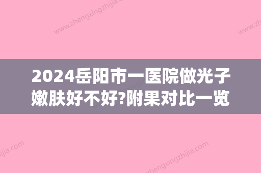 2024岳阳市一医院做光子嫩肤好不好?附果对比一览(上海岳阳医院光子嫩肤)