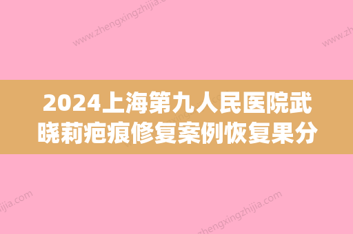 2024上海第九人民医院武晓莉疤痕修复案例恢复果分享(疤痕 上海九院)