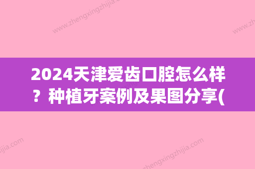 2024天津爱齿口腔怎么样？种植牙案例及果图分享(天津口腔医院种植牙价格)