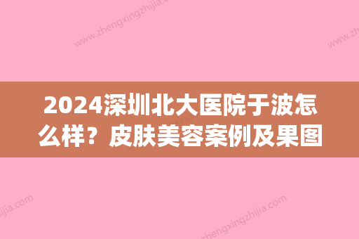 2024深圳北大医院于波怎么样？皮肤美容案例及果图展示(北大深圳医院于波博士)