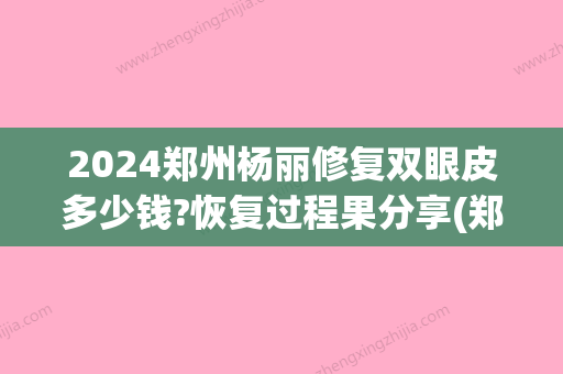 2024郑州杨丽修复双眼皮多少钱?恢复过程果分享(郑州大学第二附属医院杨丽修复双眼皮怎么样?)