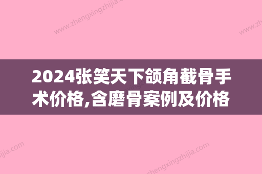 2024张笑天下颌角截骨手术价格,含磨骨案例及价格表(下颌骨长曲线截骨价格)