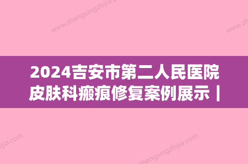 2024吉安市第二人民医院皮肤科瘢痕修复案例展示｜附体验果图(吉安疤痕公立医院)