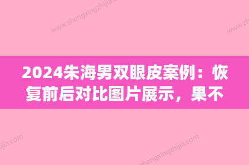 2024朱海男双眼皮案例：恢复前后对比图片展示	，果不一般(朱海男双眼皮风格)