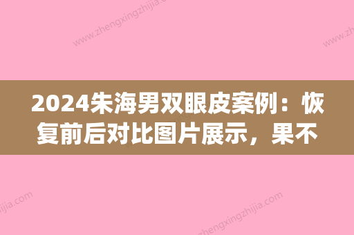 2024朱海男双眼皮案例：恢复前后对比图片展示，果不一般(朱海男双眼皮风格)