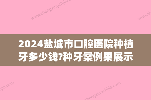 2024盐城市口腔医院种植牙多少钱?种牙案例果展示(江苏盐城种植牙多少钱一颗)