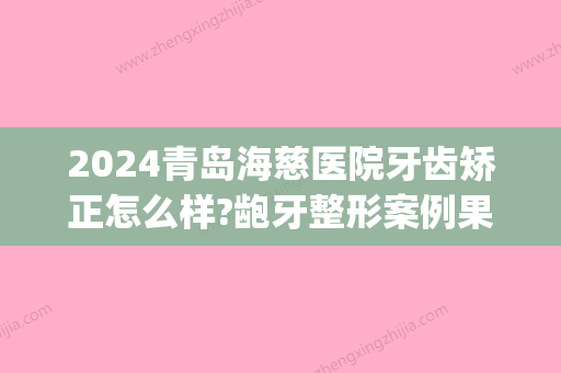 2024青岛海慈医院牙齿矫正怎么样?龅牙整形案例果一览(青岛海慈医院口腔)