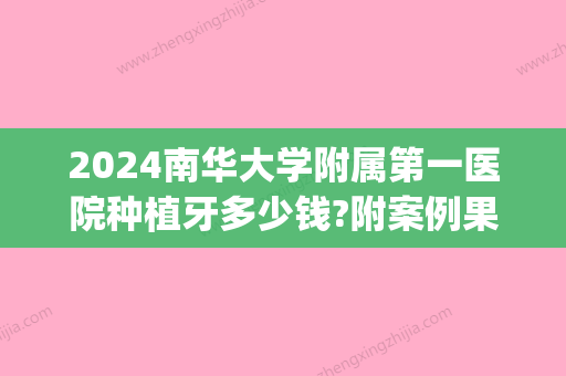 2024南华大学附属第一医院种植牙多少钱?附案例果(华西种植牙多少钱一颗2024)