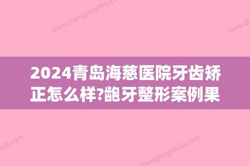 2024青岛海慈医院牙齿矫正怎么样?龅牙整形案例果一览(青岛海慈医院有牙科吗)